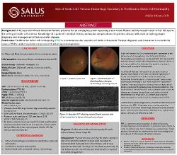 Sick of Sickle Cell: New Onset Vitreous Hemorrhage Secondary to Proliferative Sickle Cell Retinopathy
