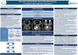 One-and-a-half Syndrome due to Metastatic Disease in a Patient with Small Cell Lung Cancer