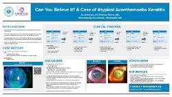 Can You Believe It? A Case of Atypical Acanthamoeba Keratitis