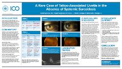 A Rare Case of Tattoo-Associated Uveitis in the Absence of Systemic Sarcoidosis