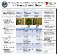 Multifactorial Neurotrophic Keratitis Treatment with Subsequent Oxervate Therapy