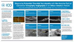 Diagnosing Polypoidal Choroidal Vasculopathy with Non-Invasive Optical Coherence Tomography Angiography in an African American Patient