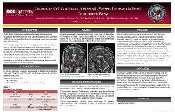 Squamous Cell Carcinoma Metastasis Presenting as an Isolated Oculomotor Palsy