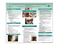 Not for Every Cone: A Case of Corneal Neovascularization following Intacs Implantation