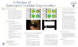 A Review of Salzmann's Nodular Degeneration
