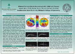 Bilateral Corneal Ectasia Secondary to RK, LASIK, and Trauma