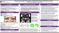 Glaucomatous Optic Neuropathy as Initial Presentation of Thyroid Eye Disease