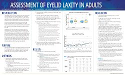 Assessment of Eyelid Laxity in Adults