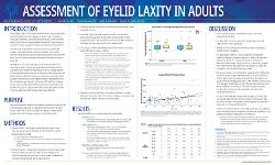 Michelle Yan, OD Assessment of Eyelid Laxity in Adults