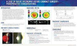 Tyler Keller, OD A case of Fuchs' Dystrophy before cataract surgery - perioperative considerations