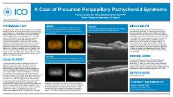 A Case of Presumed Peripapillary Pachychoroid Syndrome