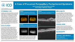 Patricia Salazar, OD A Case of Presumed Peripapillary Pachychoroid Syndrome