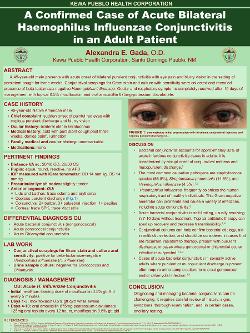 Alexandra Gada, OD A confirmed case of acute bilateral Haemophilus influenza conjunctivitis in an adult patient