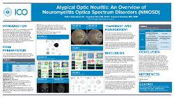 Atypical Optic Neuritis: An Overview of Neuromyelitis Optica Spectrum Disorders (NMOSD)
