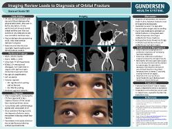 Samuel Soda, OD Imaging Review Leads to Diagnosis of Entrapped Muscle