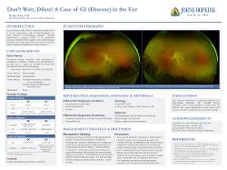 Don’t Wait, Dilate! A Case of GI (Disease) in the Eye
