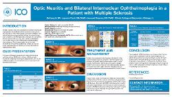 Optic Neuritis and Bilateral Internuclear Ophthalmoplegia in a Patient with Multiple Sclerosis