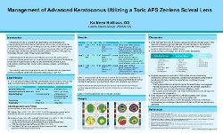 Kathleen Holthaus, OD Management of Advanced Keratoconus Utilizing a Toric APS Zenlens Scleral Lens