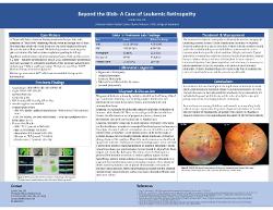 Candis Clark, OD Beyond the Blob: A Case of Leukemic Retinopathy