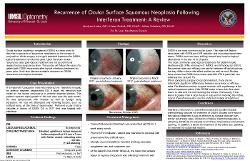 Madyson Locke, OD Recurrence of Ocular Surface Squamous Neoplasia Following Interferon Treatment: A Review