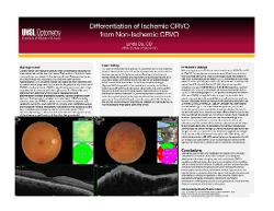 Linda Du, OD,MS Differentiation of Ischemic CRVO from Non-Ischemic CRVO