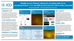 Double trouble: Branch retinal vein occlusion and retinal neovascularization in an eye with previous branch retinal artery occlusion