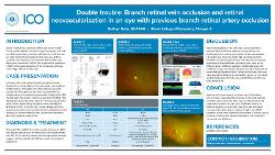 Kathryn Hohs, OD Double trouble: Branch retinal vein occlusion and retinal neovascularization in an eye with previous branch retinal artery occlusion