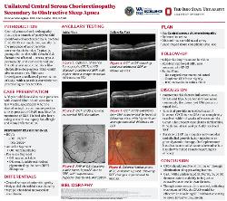 Connor Monaghan, OD Unilateral Central Serous Chorioretinopathy Secondary to Obstructive Sleep Apnea