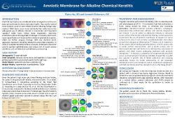 Elaine Ho, OD Amniotic Membrane for Treatment of Alkaline Chemical Keratitis