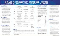A Case of Idiopathic Anterior Uveitis