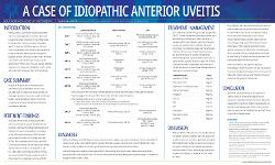 Aprile Doubt, OD,MS A Case of Idiopathic Anterior Uveitis
