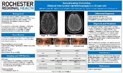 Alek Karthikeyan, OD Demyelinating Chronicles: Bilateral Internuclear Ophthalmoplegia in a 30-year-old