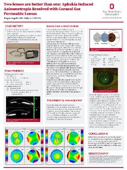 Megan Ingalls, OD Two lenses are better than one: Aphakia Induced Anisometropia Resolved with Corneal Gas Permeable Lenses