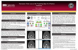 Monocular Vision Loss as the Presenting Sign of a Pituitary Adenoma