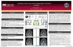 Eisha Multani, OD Monocular Vision Loss as the Presenting Sign of a Pituitary Adenoma