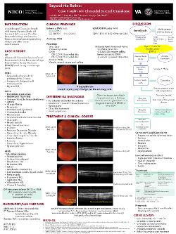 Jade Liu, OD Beyond the Retina: Case Insights into Choroidal Sarcoid Granuloma