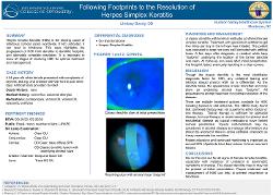 Lindsey Boody, OD Following Footprints to the Resolution of Herpes Simplex Keratitis