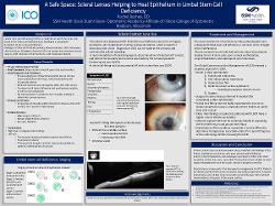 A Safe Space: Scleral lenses helping to heal epithelium in limbal stem cell deficiency