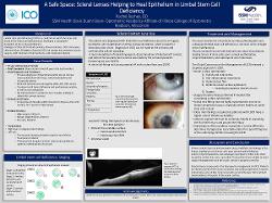 Rachel Bushey, OD A Safe Space: Scleral lenses helping to heal epithelium in limbal stem cell deficiency