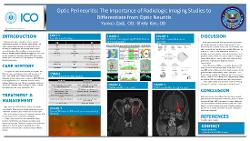 The Importance of Radiologic Studies in Diagnosing Optic Perineuritis