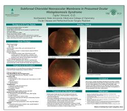 Taylor Vincent, OD Subfoveal Choroidal Neovascular Membrane in Presumed Ocular Histoplasmosis Syndrome