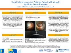 Jourdan Valkner Krause, OD Use of Scleral Lenses in a Pediatric Patient with Visually Significant Corneal Scarring