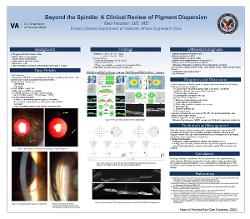 Neil Hecker, OD,MS Beyond the Spindle: A Clinical Review of Pigment Dispersion
