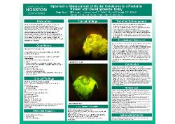 Shin Sawai, OD Optometric Management of Ocular Coloboma in a Pediatric Patient with Developmental Delay