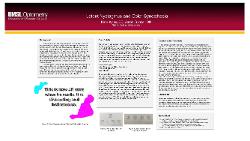 Katie Kyles, OD Latent Nystagmus and Color Synesthesia