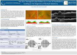 Travis Pfeifer, OD Not Your Average Dry Eye Follow Up: A Case of Papilledema Leading to the Diagnosis of Multiple Myeloma