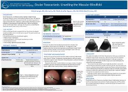 Kristin Joseph, OD Ocular Toxocariasis: Unveiling the Macular Blindfold