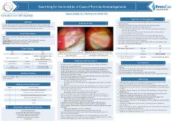 Searching for the Invisible: A Rare Case of Punctal Atresia/Agenesis