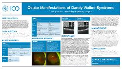 Courtney Luce, OD Ocular Manifestations of Dandy Walker Syndrome