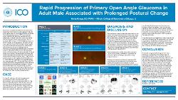 Rapid Progression of Primary Open Angle Glaucoma in Adult Male Associated with Prolonged Postural Change